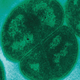 An electron micrograph of the bacterium D. radiodurans.
